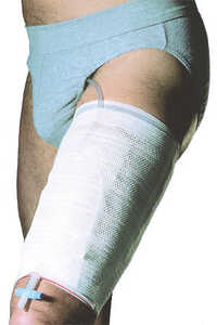 Benfixering Leggyfix L 10st